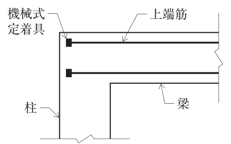 選択肢2の図